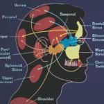 Migraine like Sinus Headaches