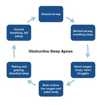 obstructive_sleep_apnea-1